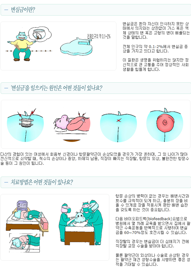 이미지명
