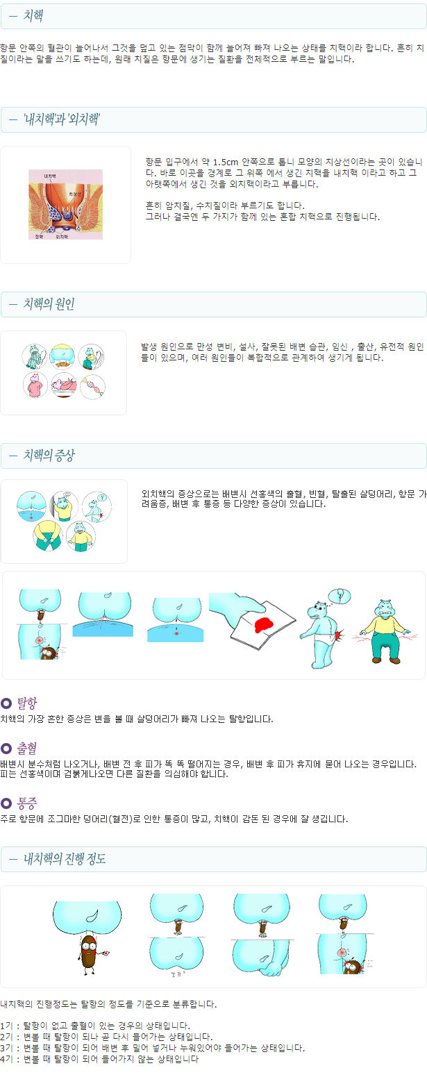 이미지명