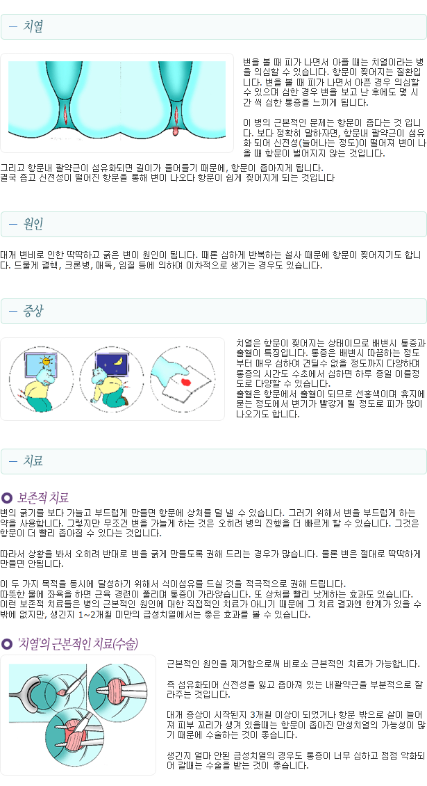 이미지명