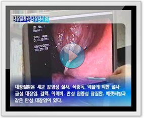 중앙케이블방송편